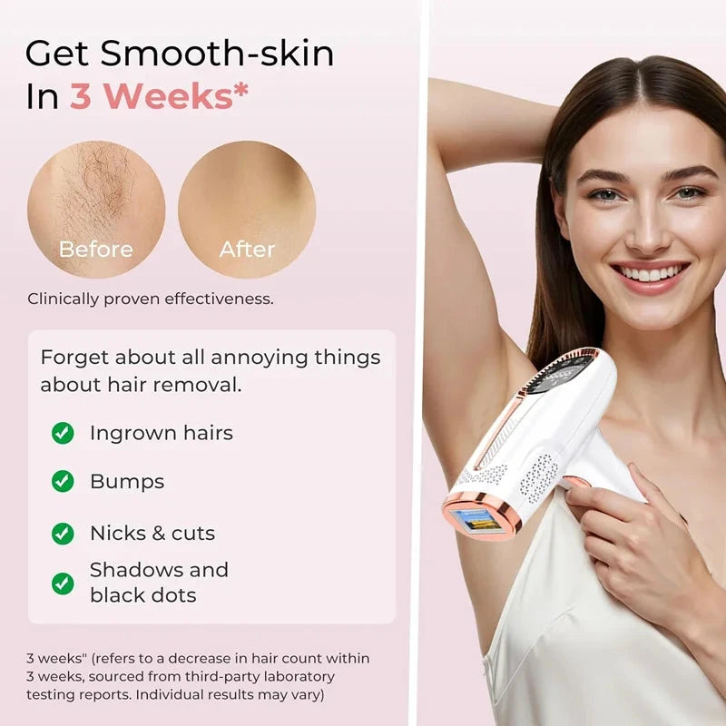 4-in-1 IPL Hair Removal Device - Permanent Laser Epilator for Painless Hair Removal | JUST FIT IN JUST FIT IN