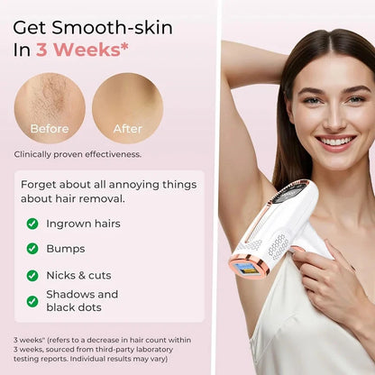 4-in-1 IPL Hair Removal Device - Permanent Laser Epilator for Painless Hair Removal | JUST FIT IN JUST FIT IN