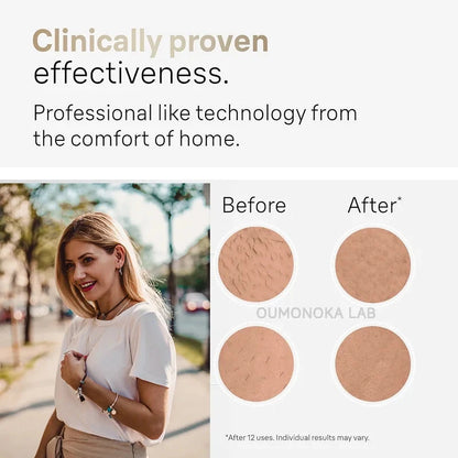 4-in-1 IPL Hair Removal Device - Permanent Laser Epilator for Painless Hair Removal | JUST FIT IN JUST FIT IN